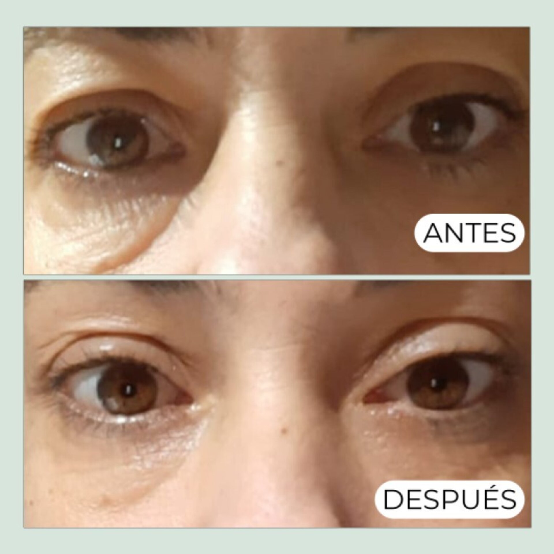 Contorno Ojos Antiedad con Aguacate - 5